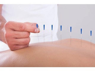 Acupuncture For IVF Support