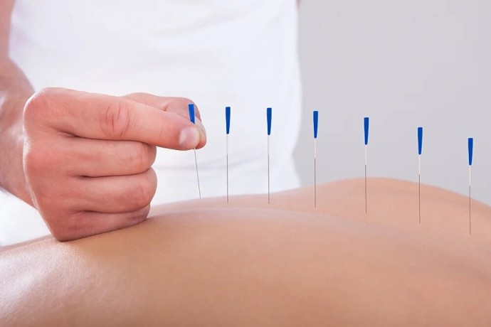 acupuncture-for-ivf-support-big-0