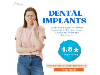 Experience Superior Dental Implant Solutions in Summerlin at Functional Aesthetic Dentistry