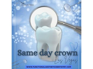 Same-Day Crowns  in Las Vegas at Functional Aesthetic Dentistry