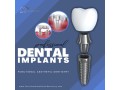 experience-superior-dental-implant-solutions-in-summerlin-at-functional-aesthetic-dentistry-small-0