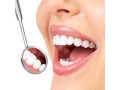 get-all-on-four-dental-at-affordable-prices-small-0